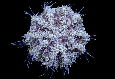 Toxopneustes Pileolus S