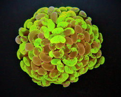 Euphyllia Paraancora (Two Tone) (P/H) Xs